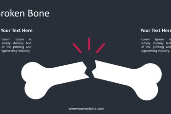 Free Fractured Bone Slides Powerpoint Template